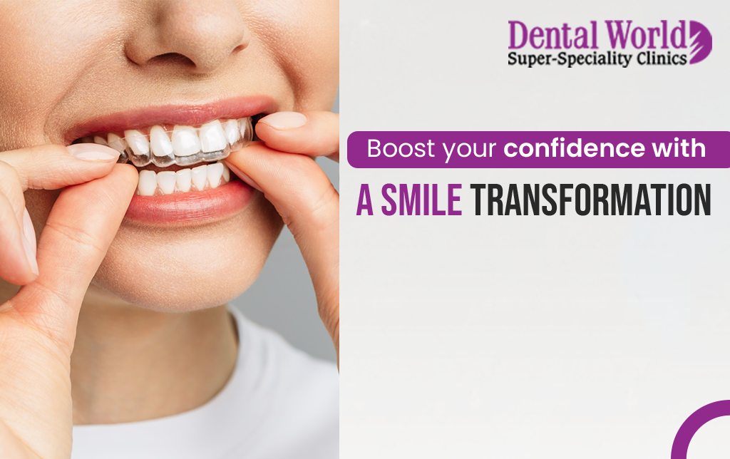 Boost your confidence with a smile transformation