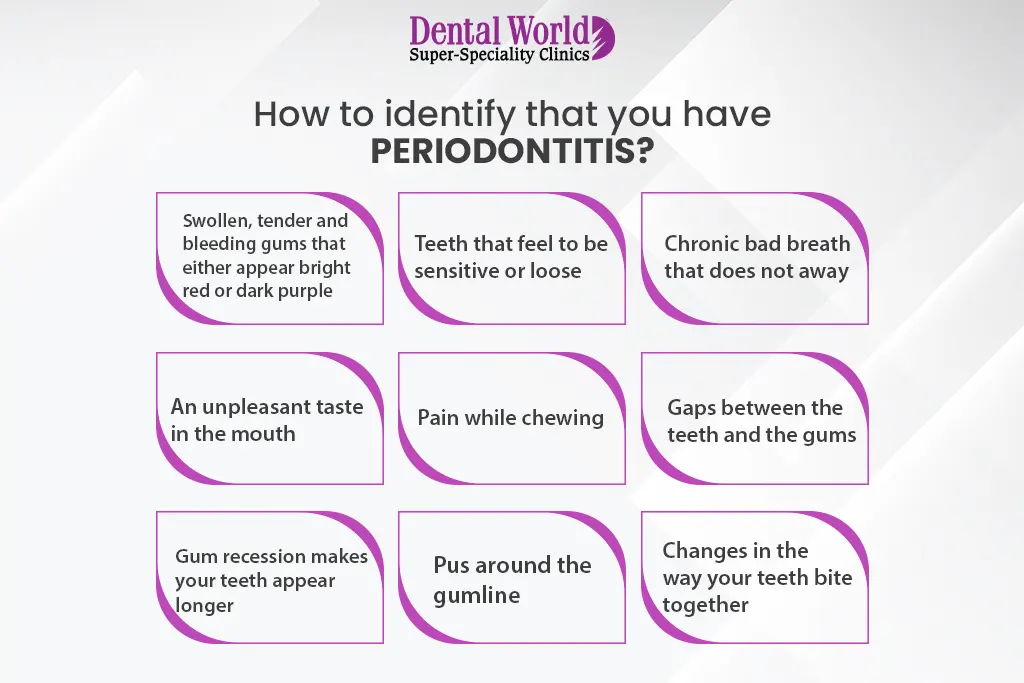 How to identify that you have periodontitis | Dental World